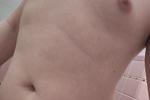 Vixess Tits 1