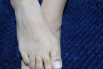 My feets Cora