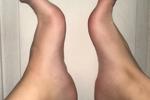 Feets