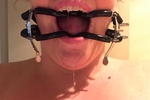 Open mouth gag
