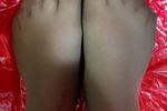 Nylon feet