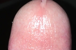 Pre-cum