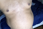 Torso