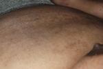leo — My nipple