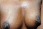 Hard nipples