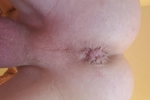 Hole
