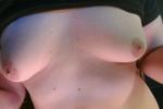 Chest