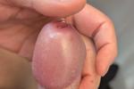 Precum