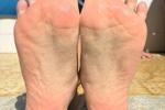 johana — feet in summer