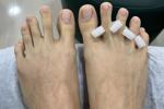 Toenails and fingernails natural