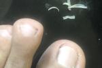 My Nails