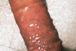 Lui
