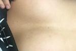 tits alix