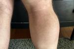 Calves Legs