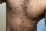 hairy