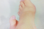 SHOW feet