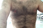 hairyness everywhere
