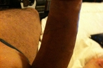 Dick