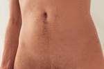My body