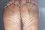 giant feet