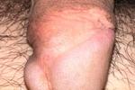 macro of my circumcised dick