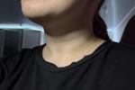 Tongue and smok