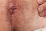 My asshole / bumhole / anus