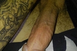 The D