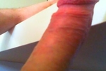 XXX