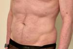 Bod and Mesh