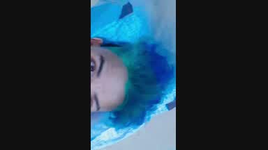 alberto โ blue king