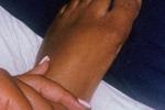 Foot Fetish