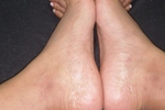feets