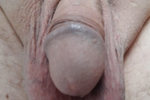 harald — My dick
