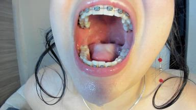 ruby โ gag extreme