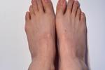my feet