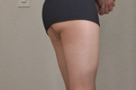 Lori