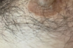 nips