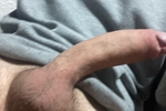 superdick