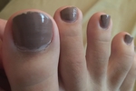 Pedicure