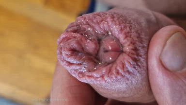 Foreskin super closeup