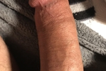weiner