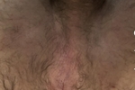 ASS HOLE