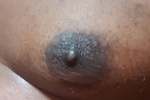 Nipple