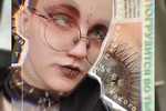 Blindness