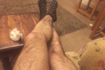 hairy legs