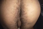 Ass pics