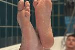 Wrinkled feet
