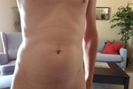 frontal