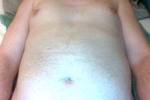 Chest